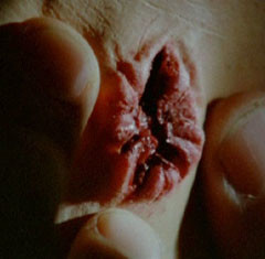 Rabid – Sete di sangue